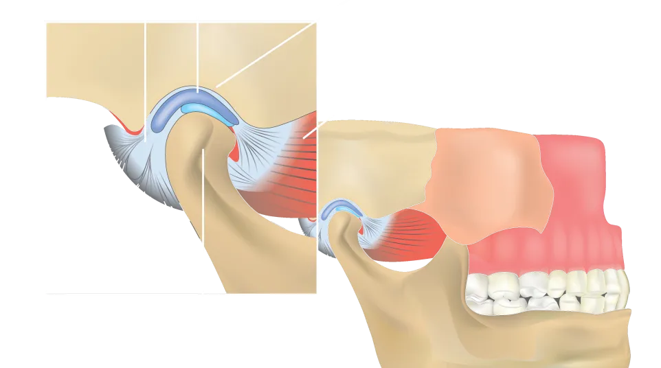 Illustration of the temporomandibular joint showing ligament, disk, condyle, articular fossa, and muscle.